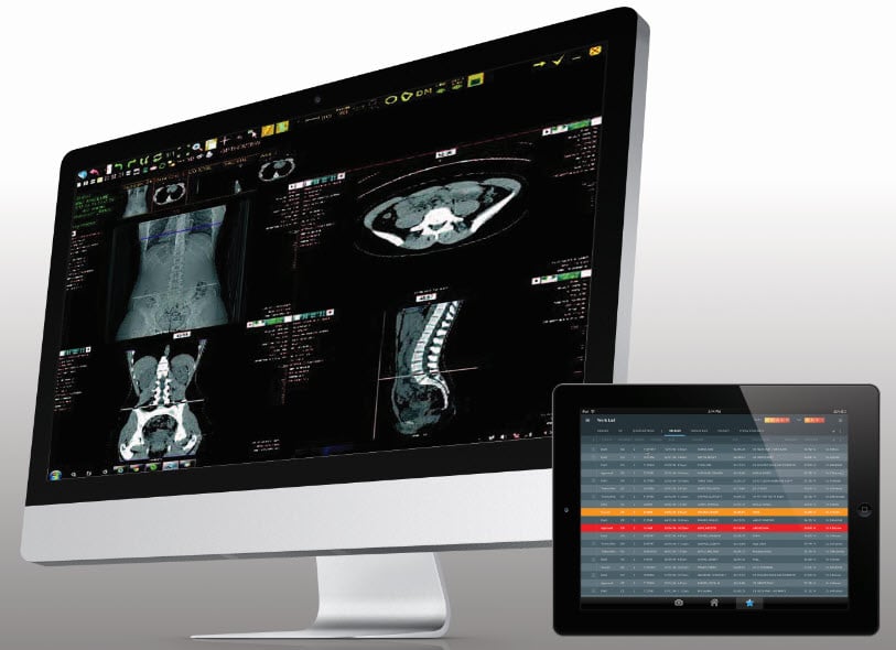 Konica Minolta’s tight integration provides many partnership opportunities, the first being a piece of technology that 1Qbit has spent nearly three years developing called XrAI. XrAI is a decision support tool that uses machine learning to identify lung abnormalities. XrAI’s algorithm works within the Konica Minolta Exa platform. #RSNA #RSNA20 #RSNA2020