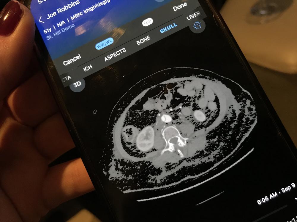 Viz.AI aortic dissection response team app enabled by AI at RSNA 2021.