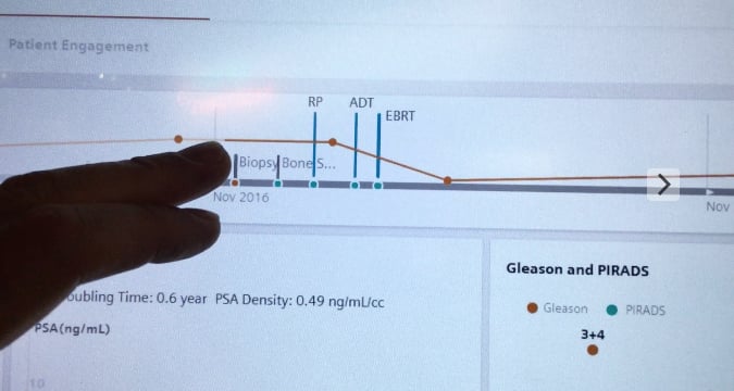 Siemens AI companion software showing a patient time line.