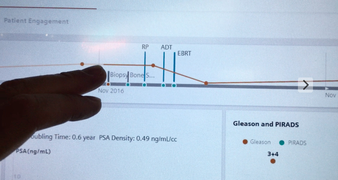 Siemens AI companion software showing a patient time line.