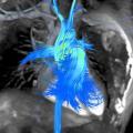 Arterys showcases AI-based tools at RSNA 2018.