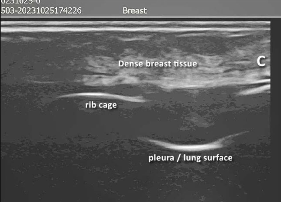 Case 2