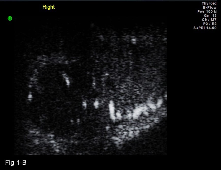 Microcirulation