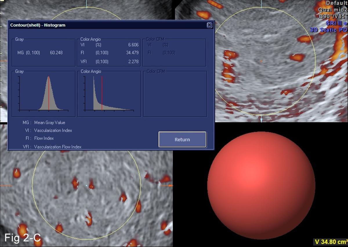 Neurovascular increase