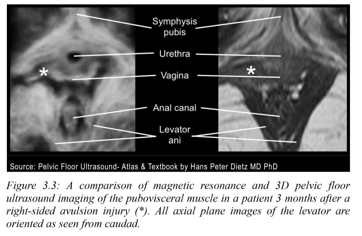 Figure 3.3