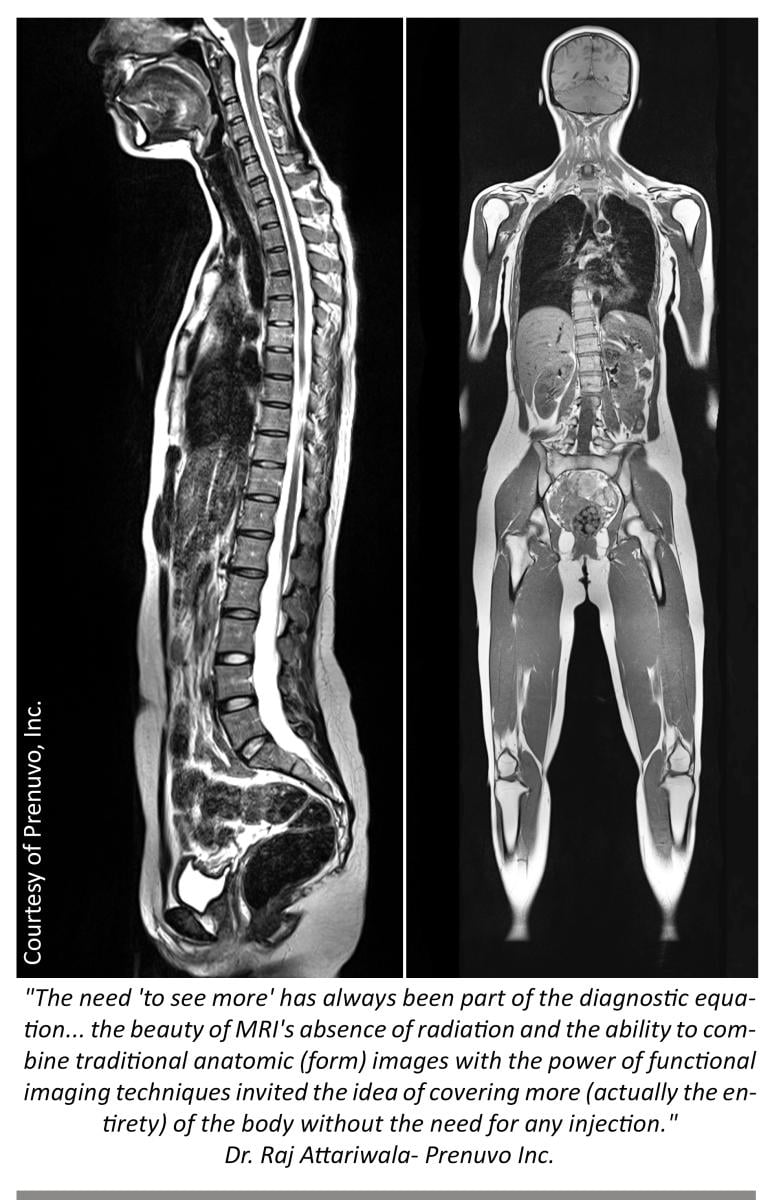 What are the best scans for imaging the body?