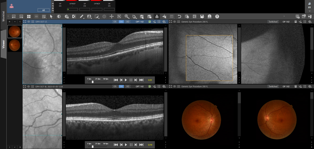 Ophthalmology PACS