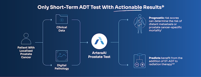 Prostate Test Diagram