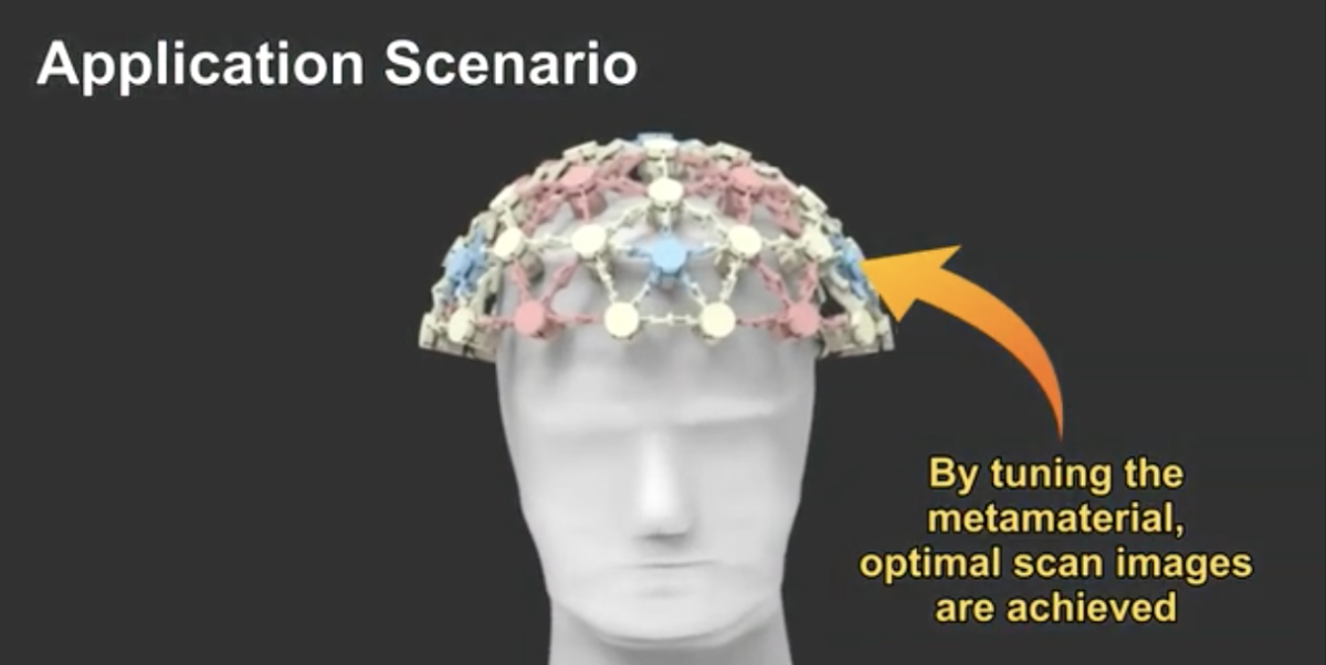 metamateral brain MRI