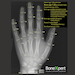 BoneXpert Pediatric Software