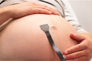 Wearable ultrasound Patch