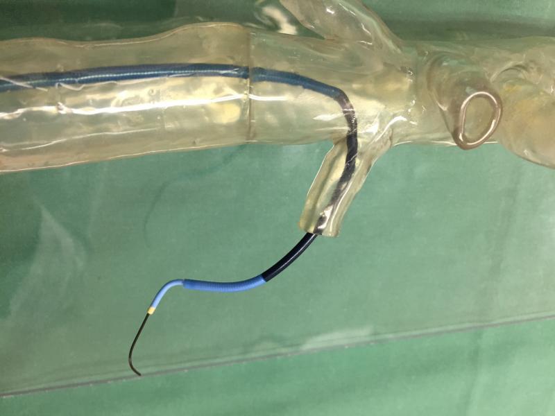 German Hospital Plans Life-Saving Vascular Surgeries With 3-D Printing