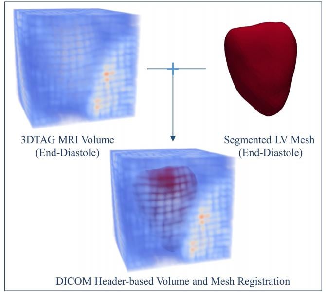 The 3DTag MRI volume and segmented LV mesh