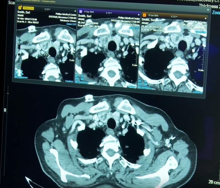 Philips’ Illumeo supports the comparison of current and prior patient images. 