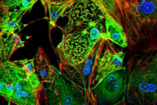 A study from Washington University School of Medicine in St. Louis provides evidence that the coronavirus can invade and replicate inside heart muscle cells, causing cell death and interfering with heart muscle contraction. The image of engineered heart tissue shows human heart muscle cells (red) infected with COVID-19 (SARS-CoV-2) (green). Read more. Image by Lina Greenberg.