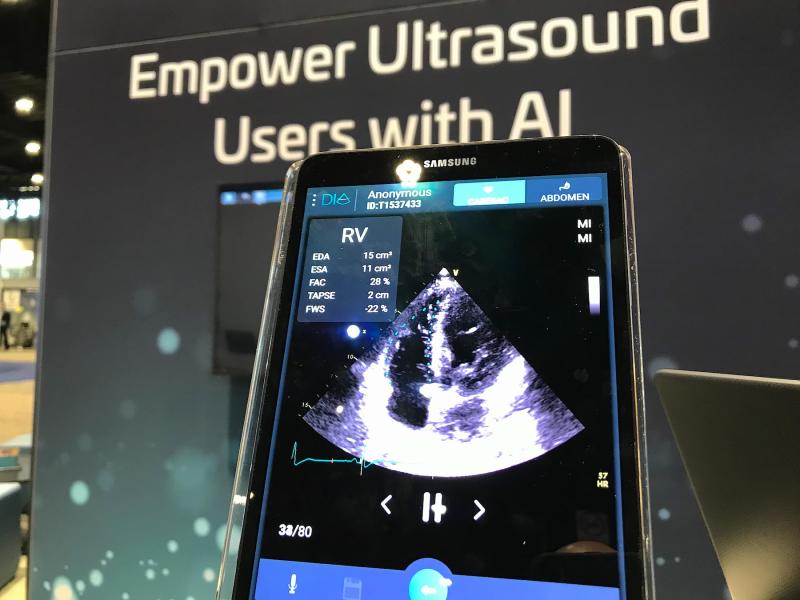 Dia provides artificial intelligence for cardiac ultrasound to automate ejection fraction and other functions. In the point-of-care ultrasound market the company can help automate cardiac analysis with AI and get consistent results, even with less experienced sonographers.  #RSNA2021 #RSNA #RSNA21 #POCUS 