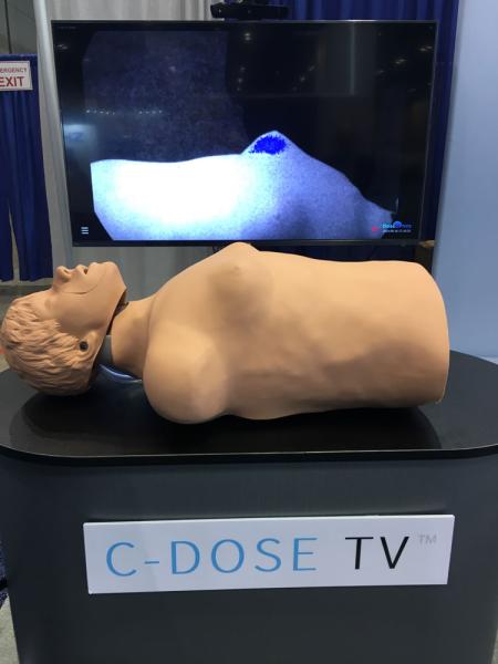 This is a real time video camera that can show radiation therapy delivery (simulated here by a laser shining on the breast) and patient motion. The Dose Optics C-Dose TV shows dose accumulation based of a sensitive camera that can show the Cherenkov radiation glow. This can help show if the beam is on target and the approximate dose delivered. It also shows if patient respiratory motion pushes the target out of the beam line, where the radiation therapist can turn it off until the #ASTRO19 #ASTRO2019 #ASTRO