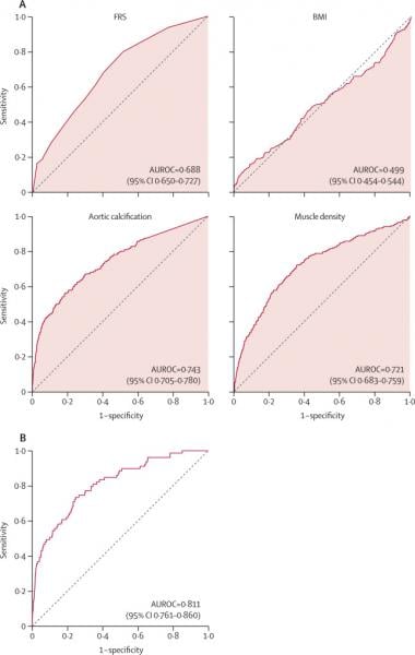 AUROCs for predicting overall survival. (A) AUROCs for the clinical parameters of FRS and BMI, as well as univariate CT measures of aortic calcification and muscle density for predicting overall survival over a 5-year time period