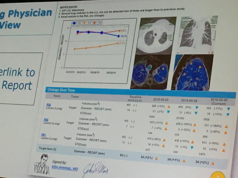 An example of how prior images for a cancer patient can be called up and embedded into a radiology report using an artificial intelligence driven software from Carestream. Radiologist Cree Gaskin, M.D., University of Virginia, explained in sessions how new enterpise imaging software allows key images and links to prior exams to be embedded into radiology reports.