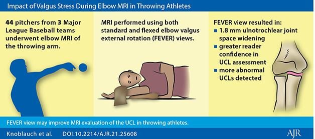 Because standard positioning for elbow MRI is often suboptimal for UCL rendering, Knoblauch, Arizona Diamondbacks head team physician Gary Waslewski, and colleagues piloted their study to assess FEVER view impact on ulnotrochlear (UT) joint space measurement and UCL reader evaluation, as incorporated with conventional elbow MRI.
