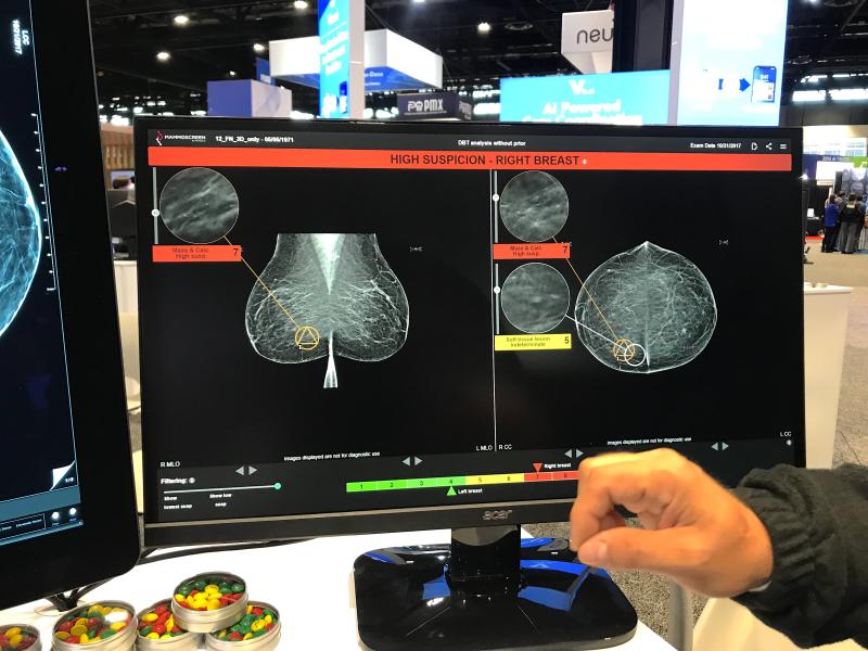 MammoScreen's artificial intelligence for mammography. The system shows the AI analysis on a different screen for the radiologist rather than embedding it on the mammograms. This allows the radiologist to review it after they read the study to serve as a second set of eyes.