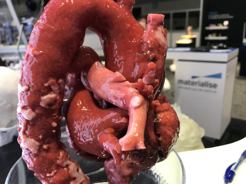 Example of life-like 3D printed cardiac and aortic anatomy available from Materialise. The vendor's software is FDA-cleared for use to print anatomy from CT or MRI studies that will be the exact size as the patient's actual anatomy. This can be used for planning and practicing complex surgical or interventional procedures and the model can aid navigation during procedures. 