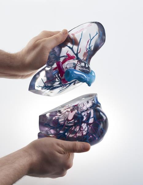 3D printing of the heart and coronary artery tree from a patient's CT scan.