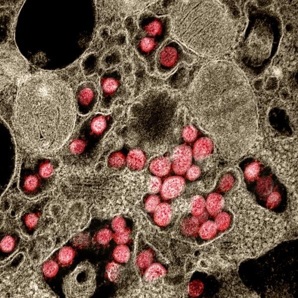 A National Institutes of Health (NIH) image of coronavirus (COVID-19) attached to a host cell.
