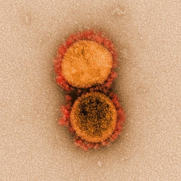 A National Institutes of Health (NIH) image of two coronaviruses (COVID-19) from high-powered microscopy.