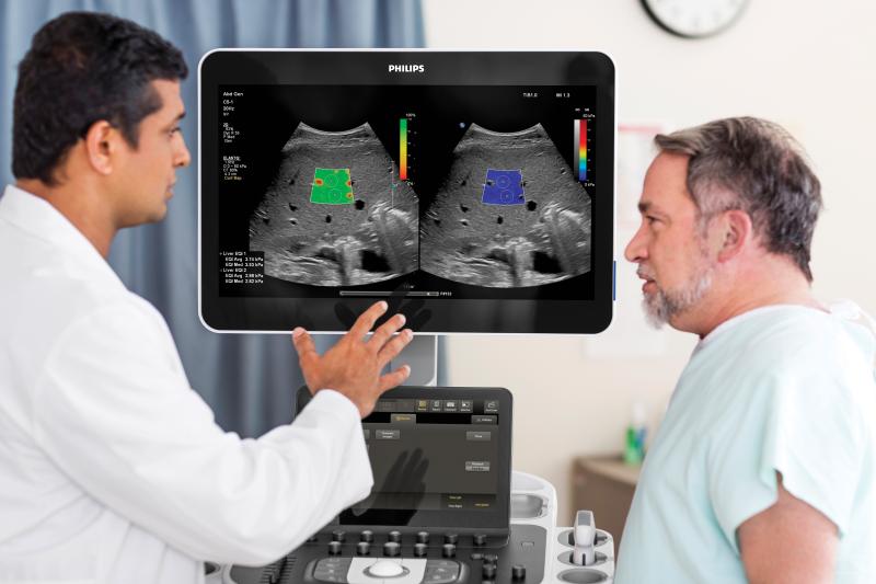 The Philips liver fat quantification tool.