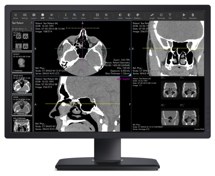 Ambra Health recently launched the Ambra ProViewer, which allows for mobile access for quick reads, and full diagnostic teleradiology capabilities from any device with a major web browser.