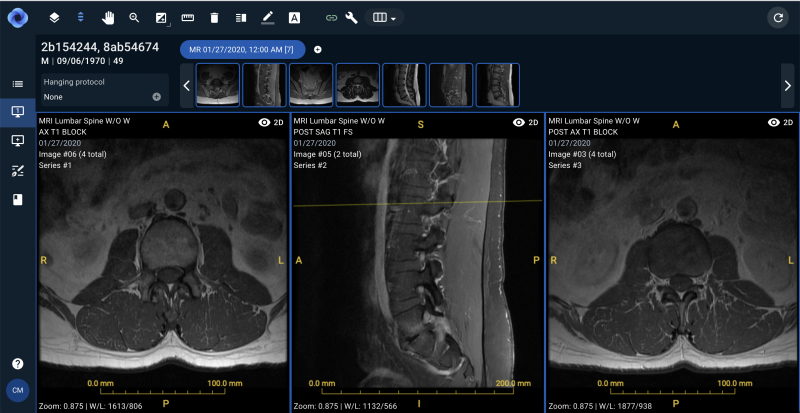 Sirona Medical, a software company founded on a deep understanding of both the practice and business of radiology, announced the launch of its cloud-native radiology operating system (RadOS) at the 2021 Annual Meeting for Radiological Society of North America (RSNA). The unified workspace platform was developed based on the principle that technology, and AI in particular, should augment the intelligence of the physician. 