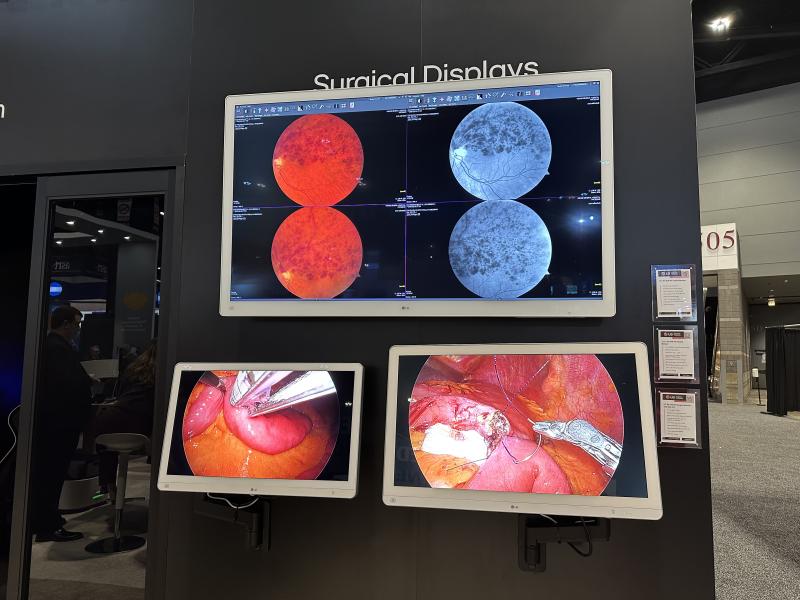LG's new 55-inch 4K Surgical Monitor (model 55MH5K) features PIP and 4PBP capability