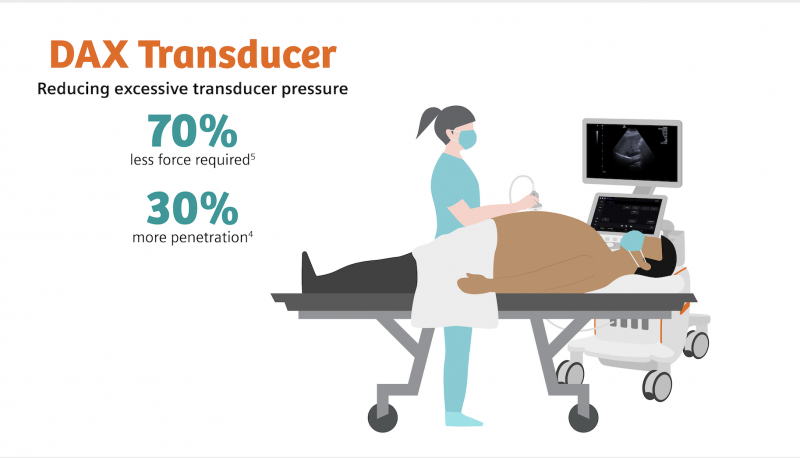 Throughout a sonographer’s career, the additional force required by traditional transducers will have a cumulative negative impact on the arm and shoulder muscles.