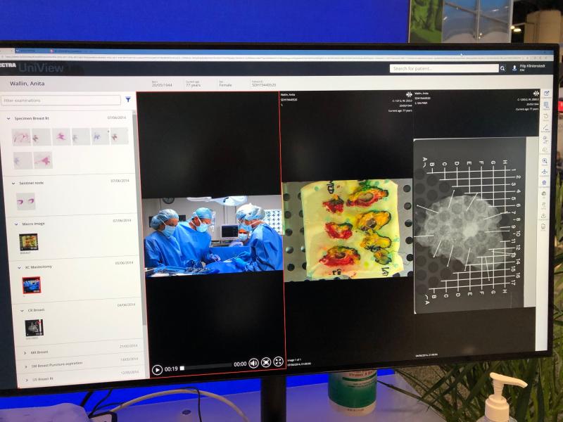 This image of Sectra's UniView Enterprise Viewer is crossing photos from pathology where it takes pictures or photos of the slices that have been created created. 