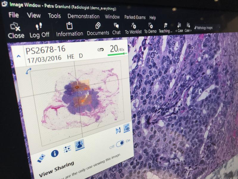 An example of a digital pathology microscope slide and a magnified image of the cells beneath it displayed by Sectra. Digital pathology is becoming a bigger part of RSNA as hospitals look at enterprise imaging system to use as a single image repository for all their image-heavy departments. 