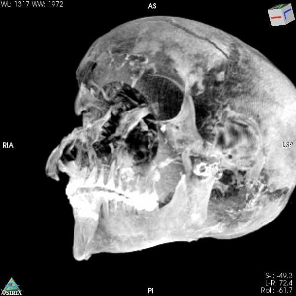 3D Virtual Reality image of the pharaoh's skull