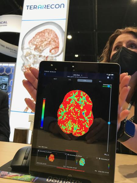 A demonstration of how advanced visualization reconstructions on the TeraRecon iNtuition system can easily be viewed and shared on a mobile device. The company has been very involved in AI the past few years at RSNA, but refocused attention on its third-party advanced visualization platform this year.  