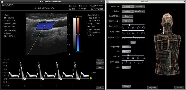 duplex ultrasound, training simulator, University of Washington, interface