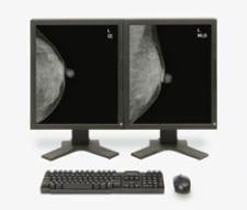 EDDA Technology offers IQQA-Chest software V2.0 featuring enterprise CAD solution for digital X-ray.