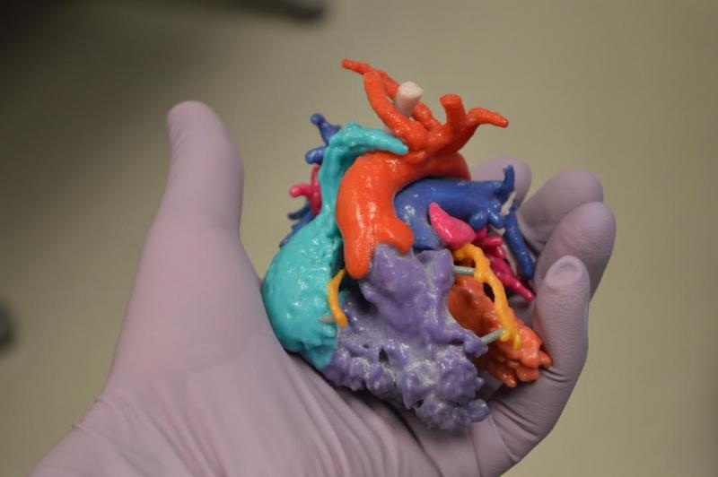 3D printing, heart