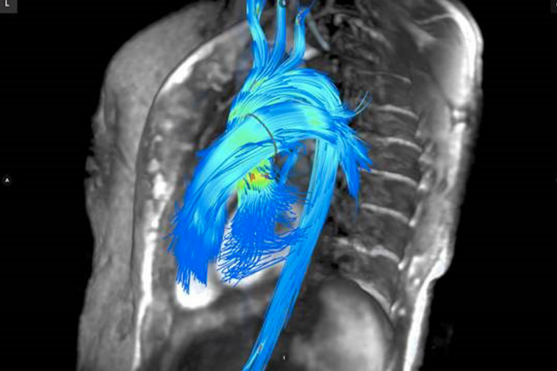 Recent MRI technological advances have opened up the possibilities for greater cardiac use of the costly imaging modality