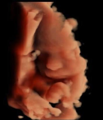 Baby face on 3-D ultrasound using Canon's Luminance lighting visualization for life-like fetal echo. Fetal imaging is referred to by many names, including pregnancy sonograms, pregnancy ultrasound, endovaginal ultrasound, obstetric ultrasound, OB ultrasound, baby ultrasound, prenatal ultrasound. Fetal heart ultrasound is also called baby echo or prenatal echo.