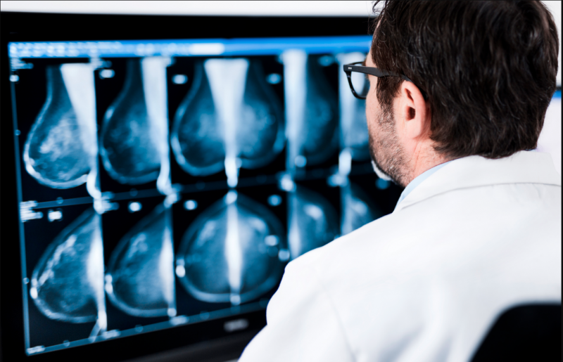 Breast imaging technologies have seen a rapid evolution. Northwestern Medicine Central DuPage Hospital Breast Health Center opened the CDH High-Risk Breast Clinic in 2017.   