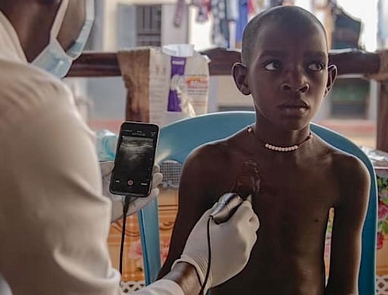 A Butterfly Network point-of-care ultrasound (POCUS) system being used in Africa. The vendor wants to democratize ultrasound, making it less expensive and available everywhere, including rural areas and the developing world.