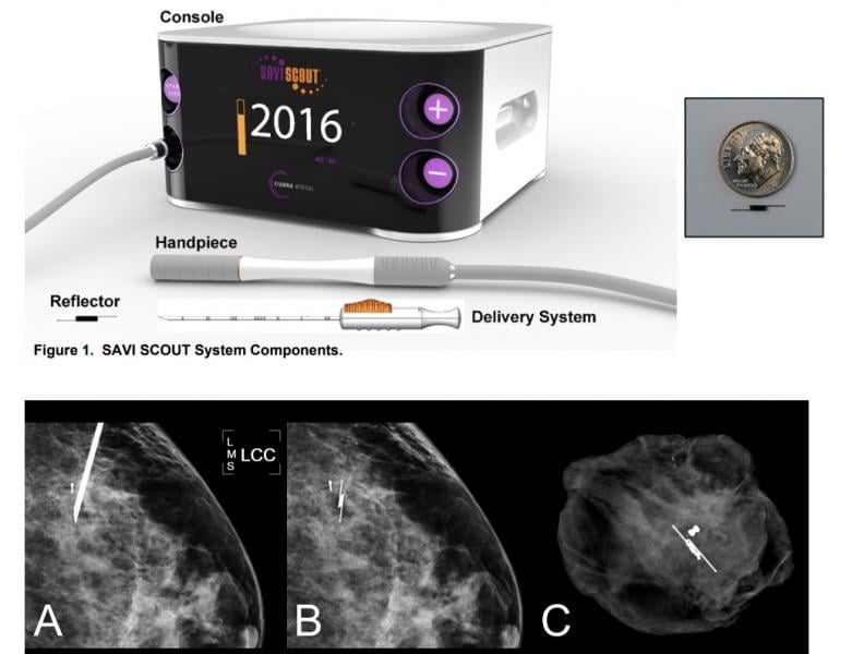 The Cianna Medical Savi Scout Radar Localization system, showing the console, detector and the marker, with a size comparison and X-ray images inside breast tissue. For more information on the learning curve of its use http://sabcs16.posterview.com/nosl/p/P1-11-06.