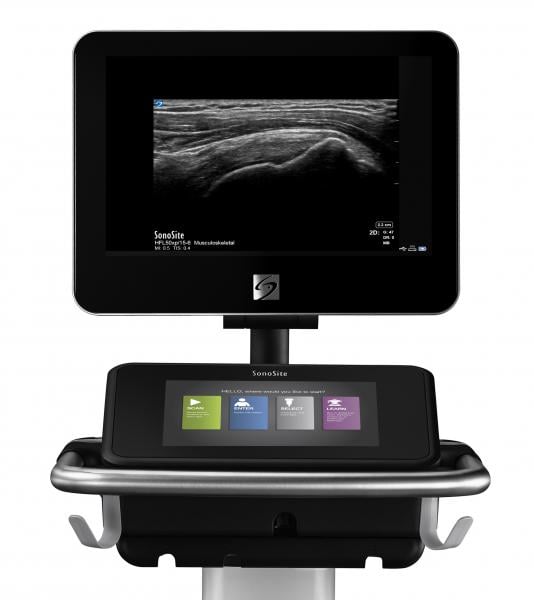 Fujifilm offers several point-of-care ultrasound systems, from cart-based to handheld. This is the SonoSite X system. 