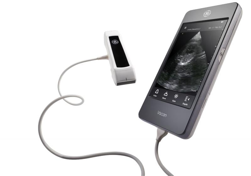 The GE Healthcare Vscan was the first commercially successful pocket-sided point of care ultrasound (POCUS) system. The latest version offers a dual probe, with a different transducer on either end.