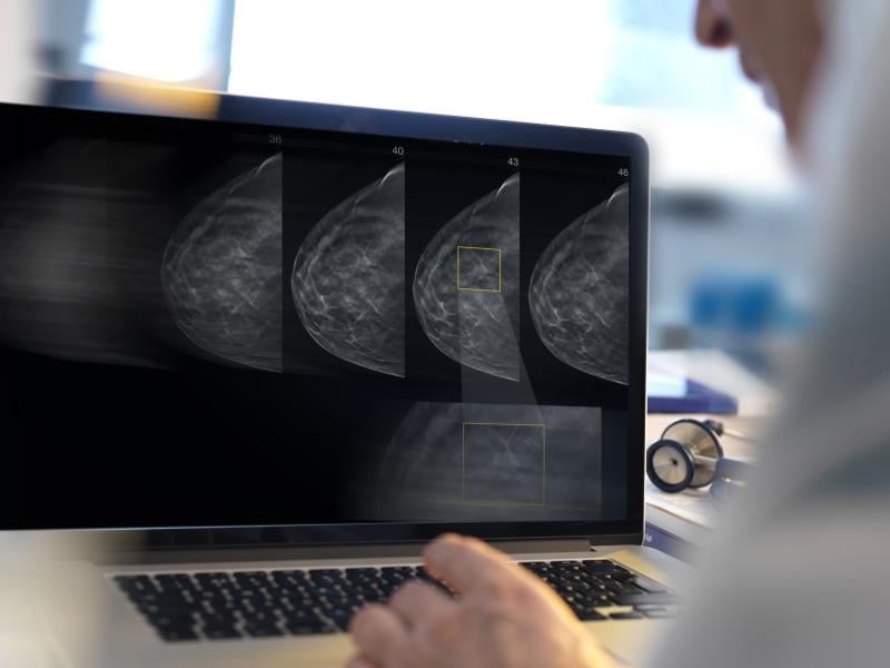 New advancements have the potential to improve early breast cancer detection, but the industry must first overcome the barriers limiting patient access to screening