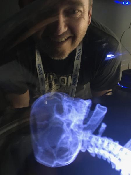 This is a hologram of a fracture CT scan displayed by the start up company Voxon at RSNA 2019. The technology uses a half millimeter thick glass plate that pulses up and down very rapidly while projecting 4,000 images per second. It can display DICOM or STL files used for 3-D printing.